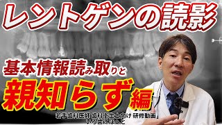 【レントゲンの読影】基本情報の読み取りと親知らず編 [upl. by Lenora]