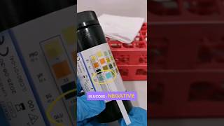 urine dipstick test laboratory medtechstudent cls mls urinalysis urine [upl. by Artemis]