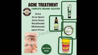 complete acne set available now  SCS  acne treatment  success chaser stars [upl. by Nais71]