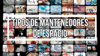 TIPOS de MANTENEDORES de ESPACIO CLASIFICACIÓN ZAPATILLA DISTAL BARRA TRANSPALATINA [upl. by Anoniw]