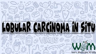 Lobular Carcinoma in Situ [upl. by Ahsinyt640]