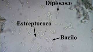 Bacterias del yogurt Observación real al microscopio [upl. by Alludba]