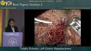 Totally Robotic Left Donor Hepatectomy [upl. by Monti]