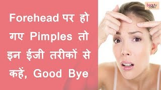 Get Rid of Forehead Pimples with these Easy Ways Hindi [upl. by Herzen472]