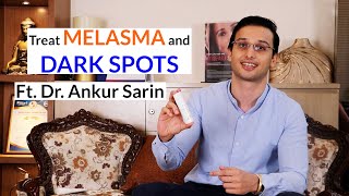 How to treat melasma hyperpigmentation amp dark spots  Dr Ankur Sarin ft Fixderma [upl. by Einallem]