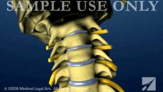 Cervical Spine and Intervertebral Disc Anatomy  Female Version [upl. by Tanner962]