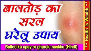 बाल तोड़ का सरल घरेलु उपाय  Home Remedies For Boils in Hindi [upl. by Roscoe856]