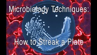 How to Streak a Bacterial Plate [upl. by Mail]