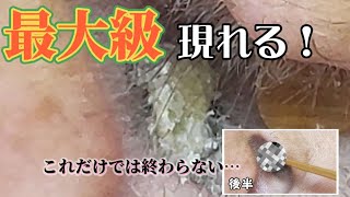 【耳掃除】30 耳かき 〜耳栓ではありません動画前半・後半に匠の技編〜 earwax [upl. by Sima]