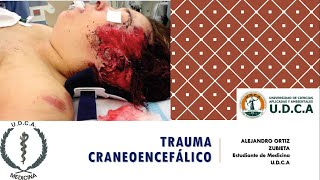 Trauma craneoencefálico TCE  Alejandro Ortiz [upl. by Burney271]