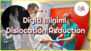 Digiti Minimi Dislocation Emergency [upl. by Tish]