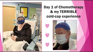 Day 1 of AC chemotherapy amp my TERRIBLE cold cap experience [upl. by Rehm]