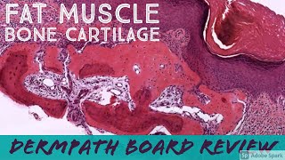 Fat Muscle Bone amp Cartilage Skin Tumors Dermpath Board Review 25 cases [upl. by Ynnaffit]