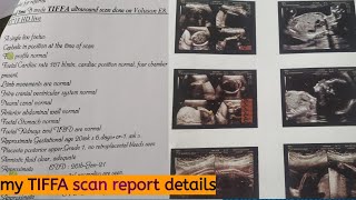 My TIFFA scan report details in telugu  gender reveal  heart rate  baby weight [upl. by Gaudet]