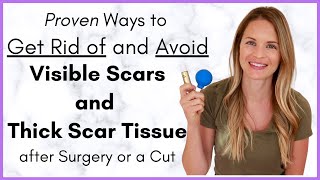 Proven Ways to Heal a Scar Quickly  Avoiding Scar Tissue after Surgery  By a Physical Therapist [upl. by Timothy]