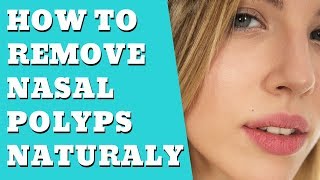 What Are Nasal Polyps  How to remove Nasal Polyps Naturally [upl. by Hsirrehc]