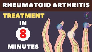 Rheumatoid Arthritis Treatment  New Medicines and Updates [upl. by Repip]