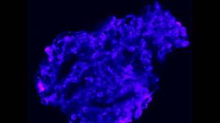 Calcium efflux fluo3 from a glomerulus Ionomycin [upl. by Eelsew]