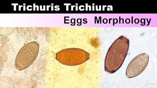 Trichuris Trichiura eggs Morphology  Clear Explain [upl. by Colman935]