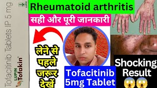 tofacitinib 5 mg tablet hindi  tofacitinib tablets 5mg  tofatas tablet 5 mg  tofakin tablet [upl. by Sharma]