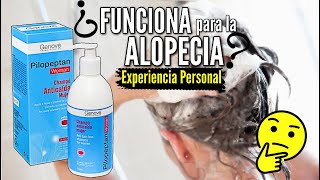 Shampoo Pilopeptan AntiCaida ¿Funciona para Detener la Alopecia [upl. by Assanav968]