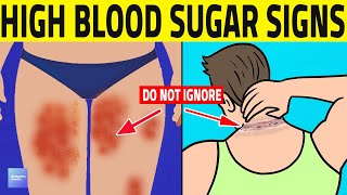 Top 7 Prediabetes Signs You Shouldnt Ignore [upl. by Dicks610]