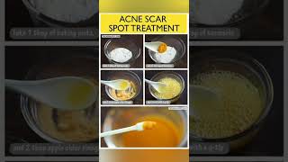 Home Remedies For Acne And Pimples ❤️❣️skincare acnetreatment shortvideo [upl. by Firooc]