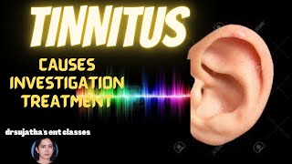 174Tinnitus Causesinvestigation and treatment tinnitus lecture ear hearingloss [upl. by Snell]