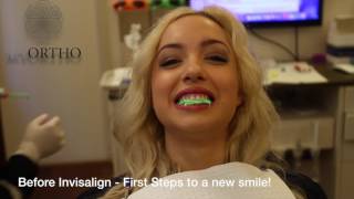 MY INVISALIGN TREATMENT EXPERIENCE  The Start of My Teeth Transformation [upl. by Burnaby]