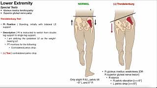 Trendelenburg Test  Rationale amp Interpretation [upl. by Rihsab]