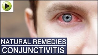 Conjunctivitis Pink Eye  Natural Ayurvedic Home Remedies [upl. by Auqenahs]