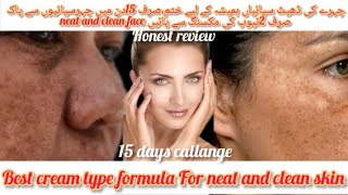 Best cream formula for neat and clean skin15 days callangeKOMAL beauty voice [upl. by Llewellyn903]