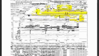 Understanding Clinical Waveforms recorded with the MB Jr  2 of 2avi [upl. by Nyliret598]