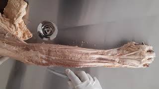 Muscles of extensor compartment of Forearm  Muscles of posterior compartment of forearm [upl. by Land852]