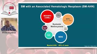 Diagnosis and management of systemic mastocytosis whats new in 2024 [upl. by Oflunra]