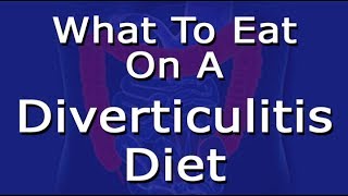 Diverticulitis Diet What To Eat [upl. by Ramses]