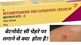 BETNOVATEC Cream  Use  How To Apply  Precautions  Side Effects  PRICE [upl. by Airotal]