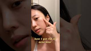 How I got rid of Acne Scar✨ Krave Beauty Great Barrier Relief • Elaband Tea Teee Patch [upl. by Winou]