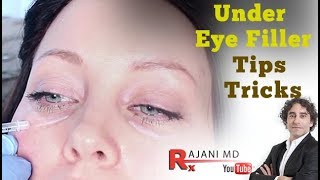 Watch Under Eye FillerTips and Tricks Portland Oregon Restylane Juvederm and PRF Injections [upl. by Reo]