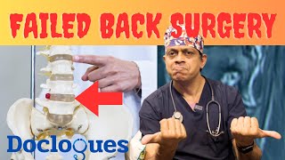 Failed Back Surgery Syndrome [upl. by Westmoreland]