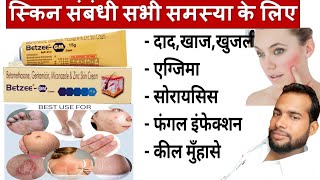 मात्र 5 दिन मे दाद खाज खुजली जड़ खत्म ।। dad khaj khujali ki dava ।। Betzee gm cream uses Hindi [upl. by Carmena12]