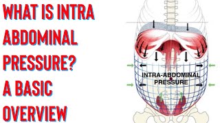 Abdominal compartment syndrome [upl. by Nataline]