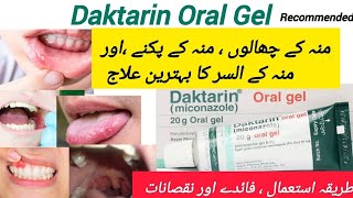 How to use Daktarin oral gel  uses in Urdu [upl. by Akim93]