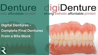 Digital Dentures – Complete Final Denture from a Bite Block in 2 Appointments [upl. by Ordnazil]