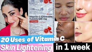 20 Benefits of Vitamin C for Skin  Limcee Vitamin C tablet for Skin remove Tan dark spots Melasma [upl. by Rad]