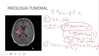 RMN CEREBRAL PATOLOGICA [upl. by Eleaffar]