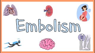 Embolism  Definition Types of Embolism amp Clinical Manifestations [upl. by Nalyd]