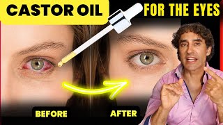 Castor Oil  Dry Eye Dark Circles Cataracts Floaters and MORE [upl. by Ervine]