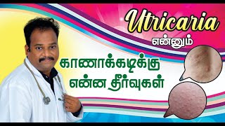 காணாக்கடி சுலபமாக சரி செய்ய சித்த வைத்தியம் URTICARIA  home remedies for skin diseases in tamil [upl. by Chryste]