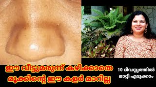 മൂക്കിൻ്റെ കുറുകെ വരുന്ന കറുത്ത വര മാറാൻ get rid of nose pigmentation [upl. by Harac]